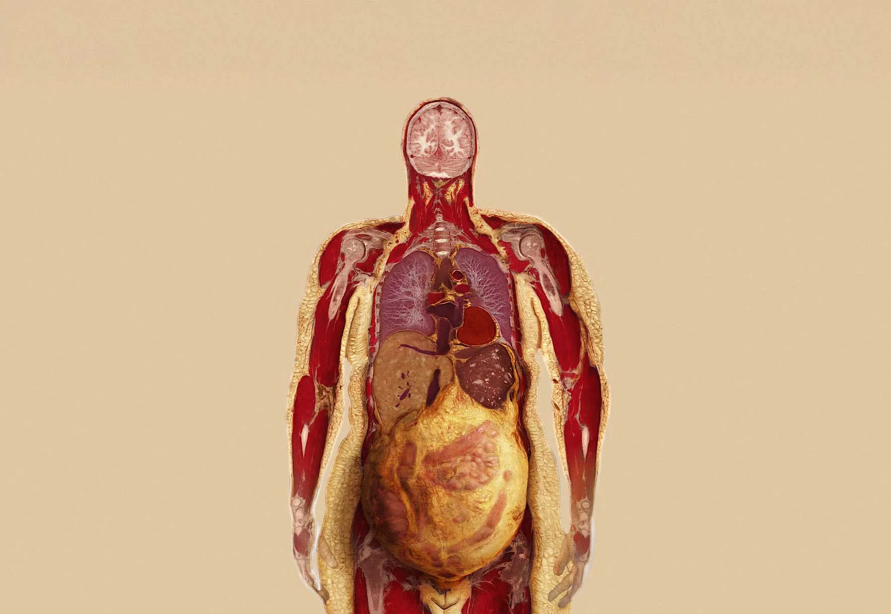 Important to Know and Reduce Visceral Fat